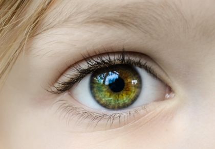 Fotografie ke článku Jak se zbavit očních vrásek  – Esthé Laser Clinic