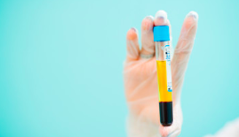 Fotografie ke článku Plazmaterapie a její využití  – Esthé Laser Clinic