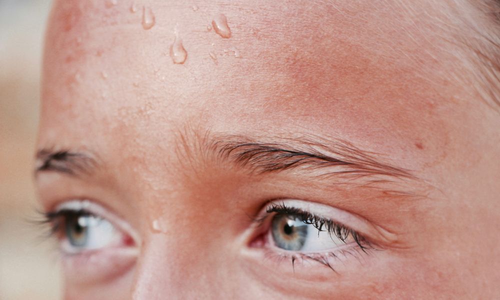 Fotografie ke článku Zbavte se nadměrného pocení – Esthé Laser Clinic