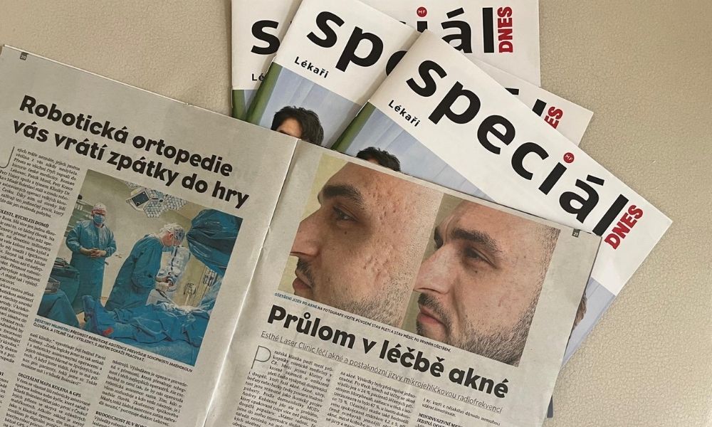 Fotografie ke článku MF Dnes Speciál – článek o léčbě akné Morpheem8 – Esthé Laser Clinic