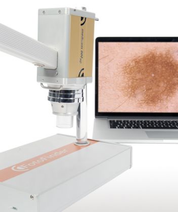 Fotografie ke článku Digital Dermatoscope – Esthé Laser Clinic