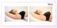 Underarm epilation