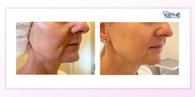 Morpheus8 – služba 2207